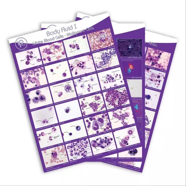 Body Fluid Pathology Reference Poster Body Fluid I: WBCs-Malignant Cells Poster ,1 Each