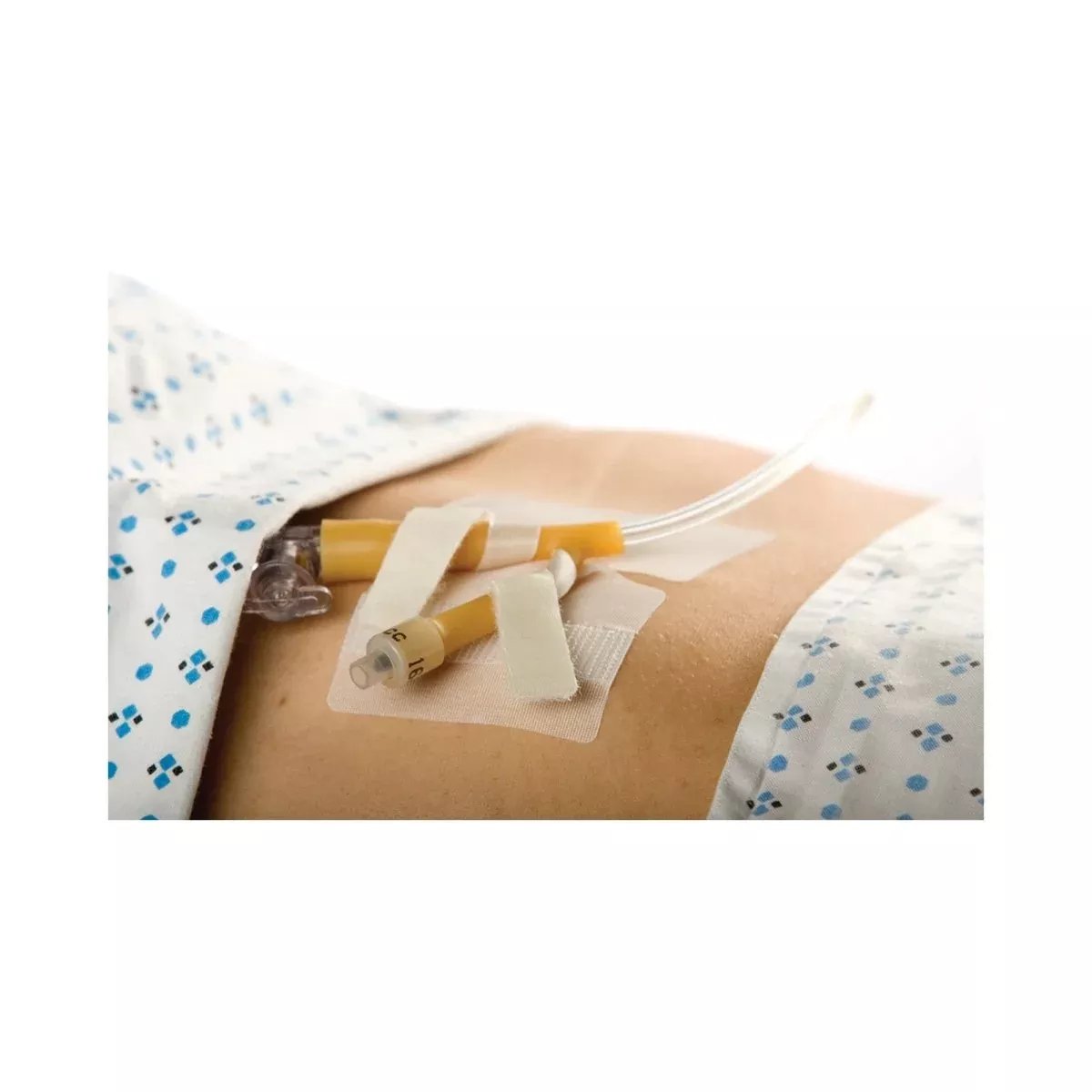 Cath Secure Dual Tab Catheter Holder