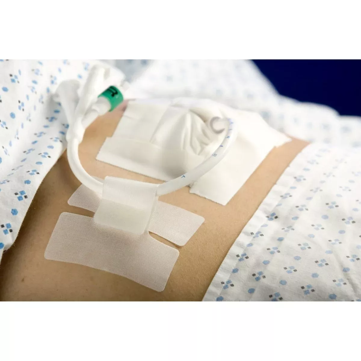 Cath Secure Holder