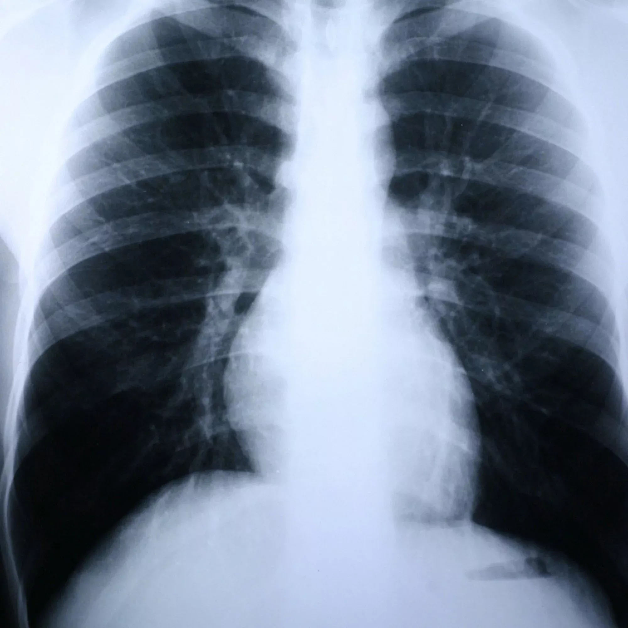 Clear Choice Performance X Ray Film