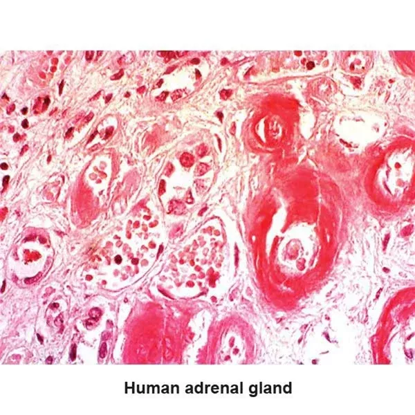 Congo Red Amyloid Stain Kit 100mL Kit ,1 Each