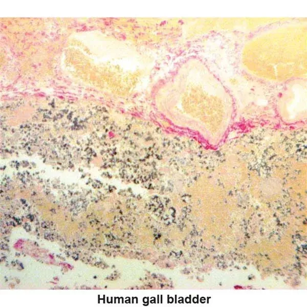 Hall Bile Stain Kit Bile Control Slides ,Pack oF 25