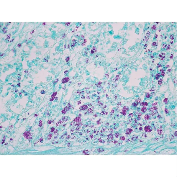 Histopathology Control Slides Acid Fast Bacteria (AFB) Animal Pos ,10 / pk