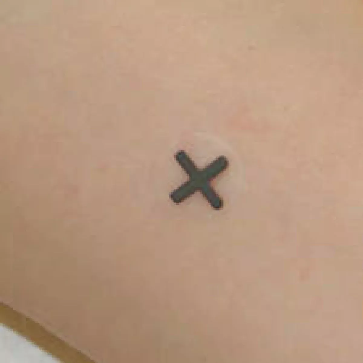 Indicator Radiology Skin Marker Reference Point Crosses Radiopaque 10Mm - 130 Per Box