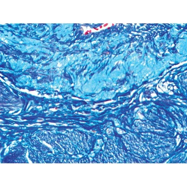 Mallory Trichrome Stain Kit Pint Kit ,1 Each