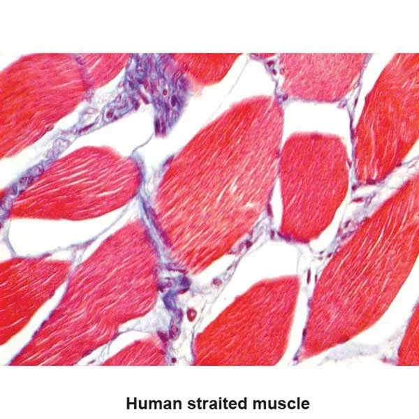 Masson 2000 Trichrome Stain Kit 100mL Kit ,1 Each