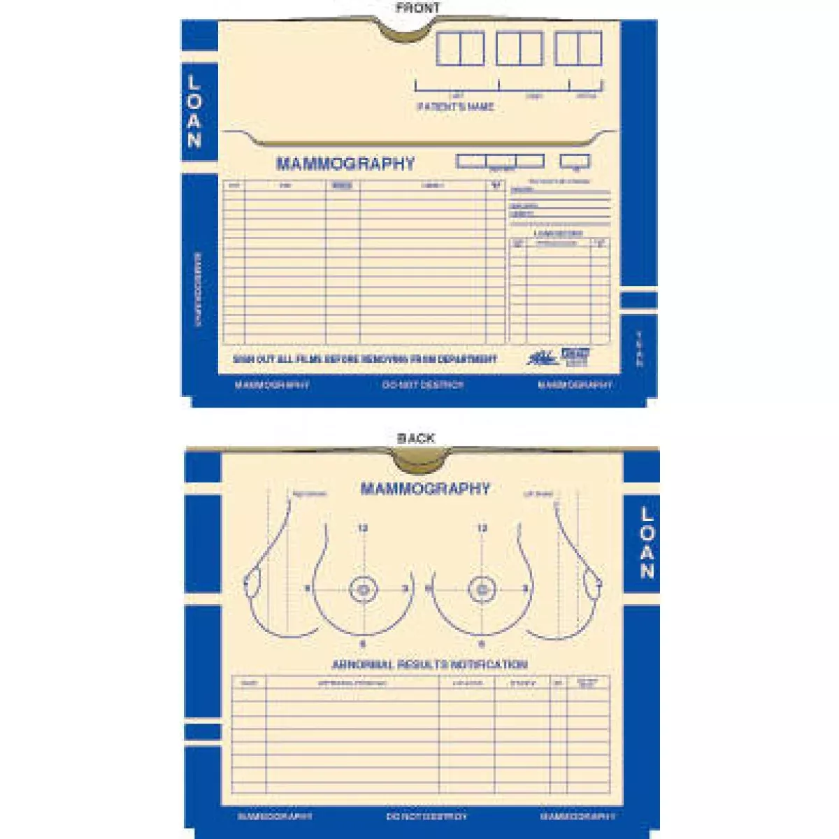 Master Jacket, With Pocket 11Pt Manila Blue Border Mammography 14" X 11" - 200 Per Case