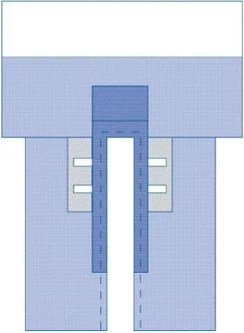 Medline Cardiovascular Split Drapes with Clear Anesthesia Screen and Pouch, Sterile - DYNJP4008
