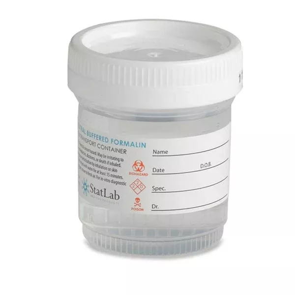 Neutral Buffered Formalin Pre-Filled 10% NBF • 60mL vial/30mL Fill ,96 / pk