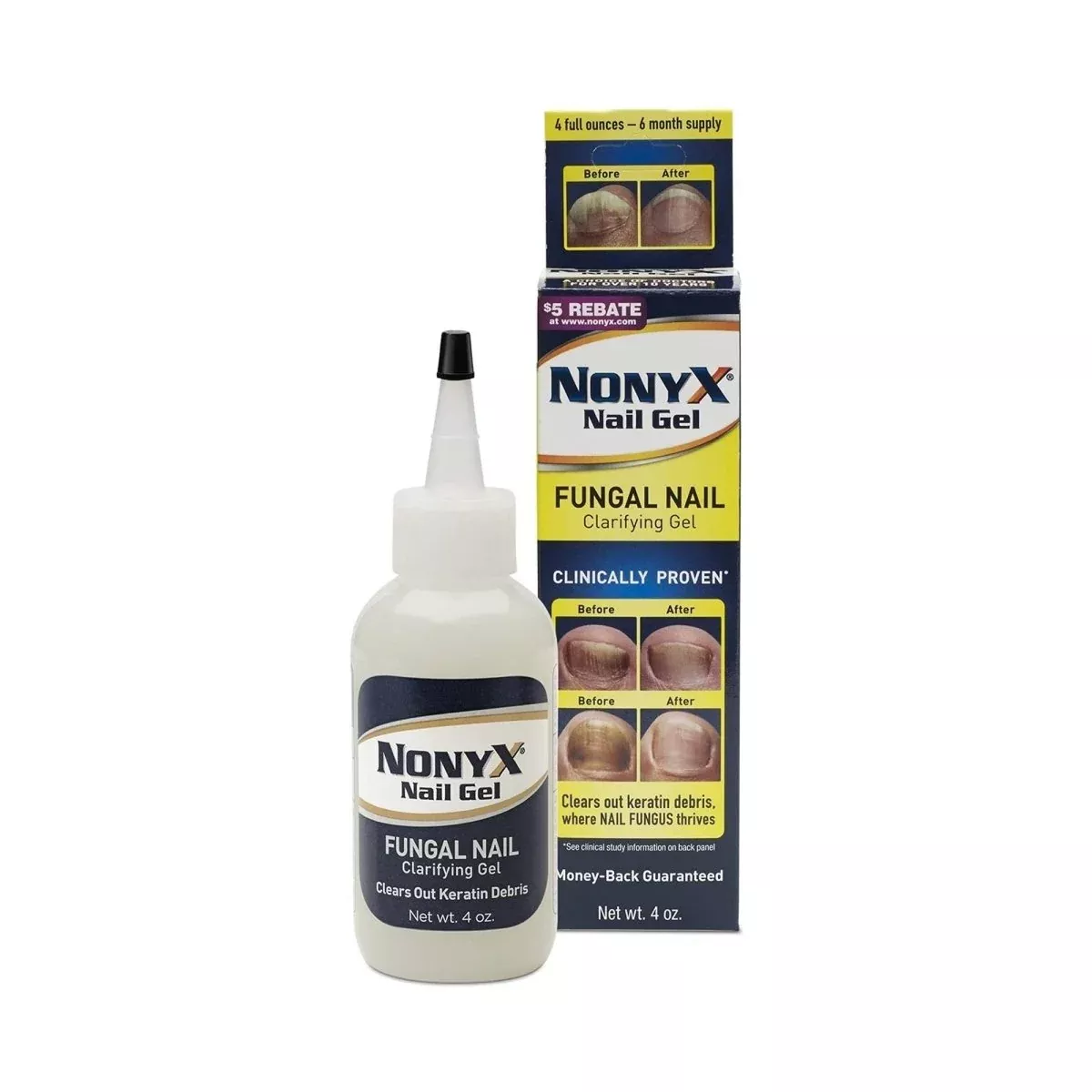 Nonyx Ethanoic Acid Antifungal