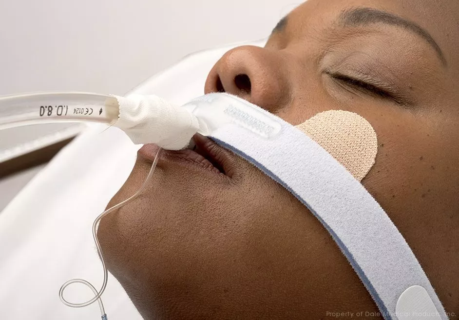 Stabilock Endotracheal Tube Holder - 270